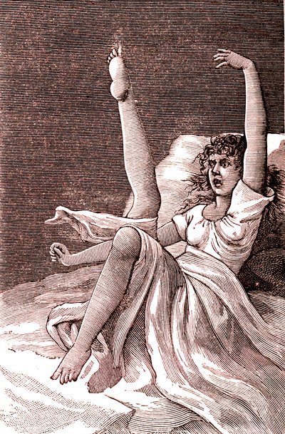 Hysteri, et ekstremt mentalt fænomen, psykoser og psykoneurose.1887 (gravering) af French School