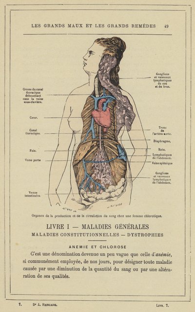 Organer for blodproduktion og cirkulation hos en klorotisk kvinde (farve litho) af French School