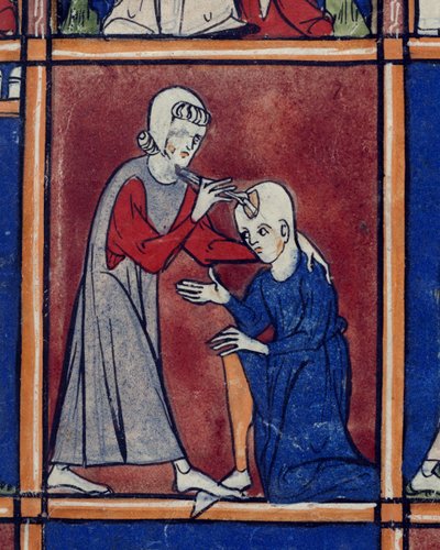 Sloane 1977 f.2 Operation på en patients kranie, illustration fra 