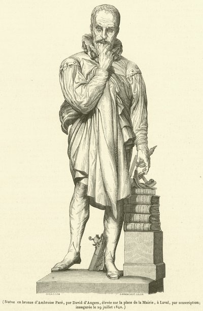 Bronzestatue af Ambroise Pare (gravering) af French School