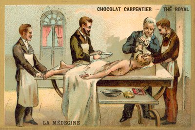 Trepanning (chromolitho) af French School