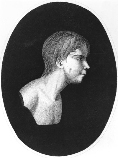 Victor of Aveyron, frontispice af De lEducation dun homme sauvage af J.E.Itard af French School