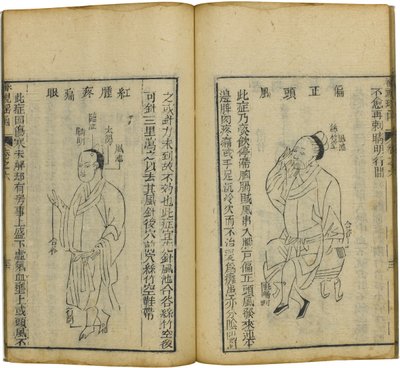 Shen Shi Yao Han A Precious Book of Ophthalmology, 1644 af Fu Renyu