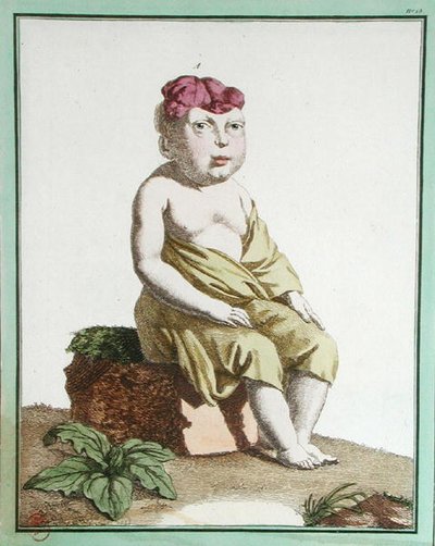 Barn med et halvt hoved, fra "Les Ecarts de la Nature", Paris af Genevieve Regnault de Nangis