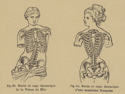 Sammenligning af formen af brystet og brystkassen på Venus de Milo med formen af en fransk socialite fra det sene 19. århundrede af German School