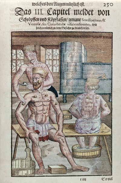 Cupping, fra Ophthalmodouleia af Georg Bartisch (1535-1636) udgivet i Dresden i 1583 (træblok i farver) af German School
