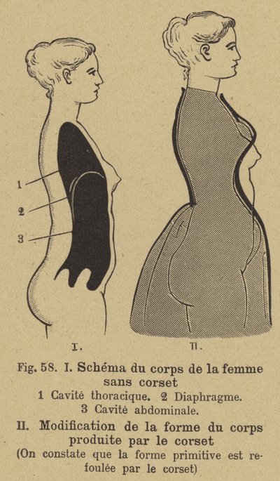 Diagram, der viser effekten af at bære et korset på formen af en kvindes krop af German School