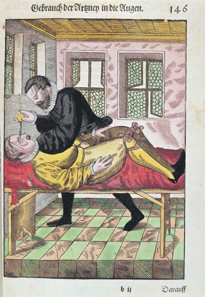Eye Operation, fra Ophthalmodouleia af Georg Bartisch (1535-1636) udgivet i Dresden i 1583 (træblok i farver) af German School