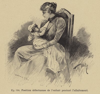 Forkert position af en baby under amning af German School