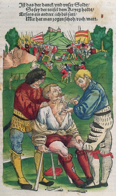 Fjernelse af en pil, illustration fra Feldtbuch der Wundartzney af Hans von Gersdorff, 1540 af German School