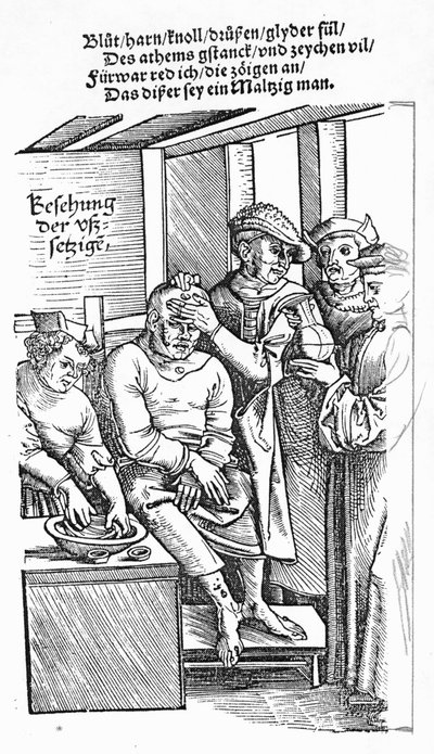 Behandling af en patient (træsnit) (bw foto) af German School
