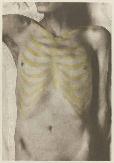 Anatomisk foto af een mannelijk lijk: 