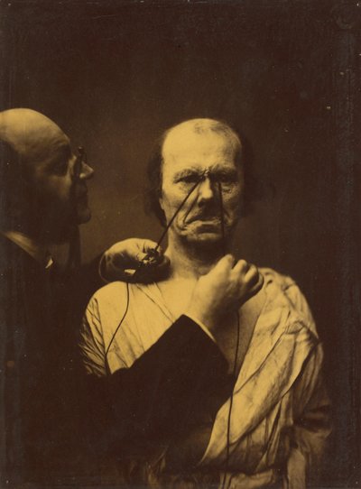 Aggression, ondskab af Guillaume Benjamin Amant Duchenne