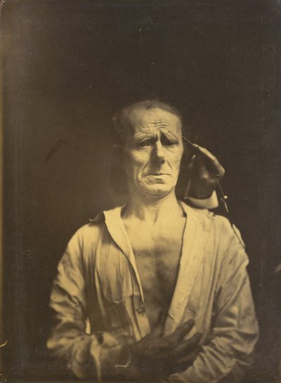 Spasmer af m. corrugator supercilii under meget stærkt lys (venstre); Et afslappet ansigt (fotograferet i fuld solskin) (til højre) af Guillaume Benjamin Amant Duchenne