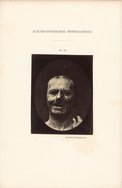 Fotografisk elektrofysiologi, figur 53 af Guillaume Benjamin Duchenne