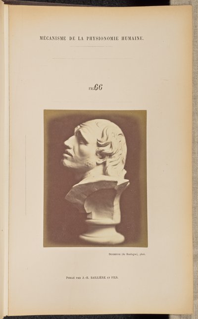 Fig. 66 af Guillaume Benjamin Duchenne