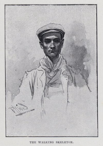 Det vandreskelet (s/h-billede) af Harold Hume Piffard