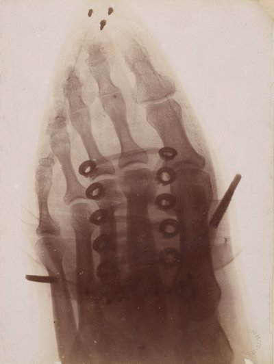 Foden gennem skoen, 1896. af Henri van Heurck