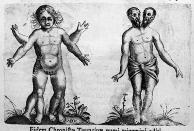 Forskellige typer menneskelige monstre Gravering fra "Monstrenes natur, deres årsager og forskelle" af Fortunio Selvomi (1577-1656), italiensk videnskabsmand. 1646 af Italian School