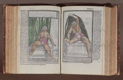 Kvindelig anatomi, fra kommentarer til verdens anatomi med de største tilføjelser, af Jacopo Berengario da Carpi (ca. 1460-c. 1530) udgivet i Bologna, 1521 (farvet træbloktryk) af Italian School
