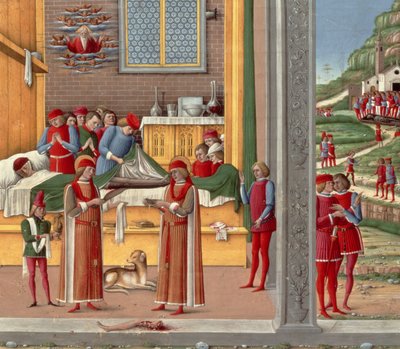 Middelalderlig amputationsscene (tempera på panel) af Italian School