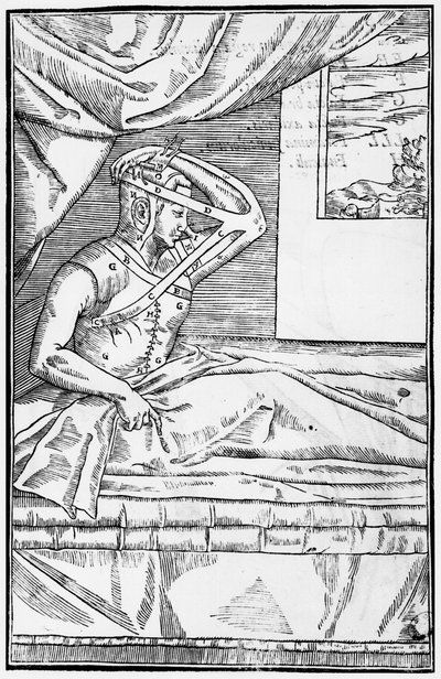 Rekonstruktiv kirurgi på næsen, illustration fra De curtorum chirurgia per insitionem af Gaspare Tagliacozzi (1545-99) Venedig, udgivet 1597 af Italian School