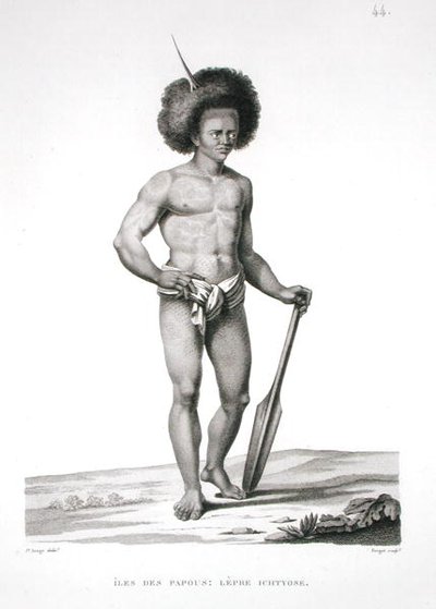 Papua-øerne: Spedalskhedsoffer, fra 