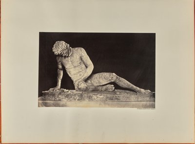 Den døende gladiator, set forfra (Capitol) af James Anderson