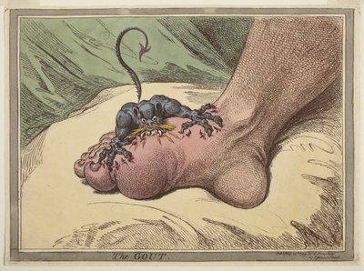 Gigten af James Gillray