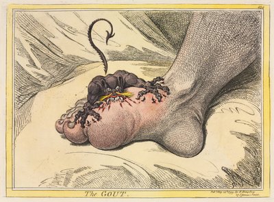 Gigten, 1799. af James Gillray