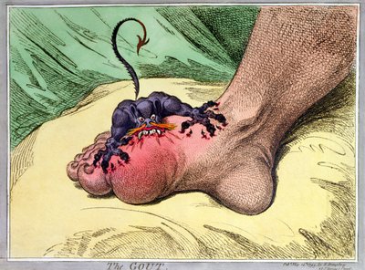 The Gout, udgivet af Hannah Humphrey i 1799 (håndfarvet softdground radering) af James Gillray