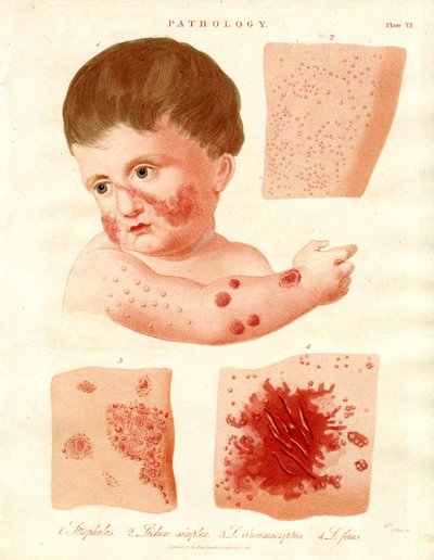 Patologiske hudsygdomme af John Pass