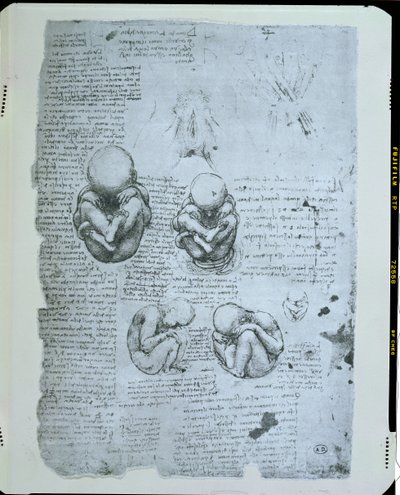 Fem visninger af et foster i livmoderen, faksimilekopi af Leonardo da Vinci