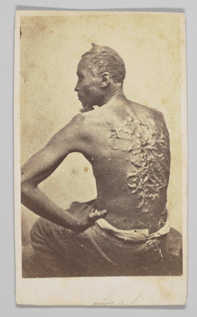 Gordon under medicinsk inspektion, 1863. af McPherson and Oliver