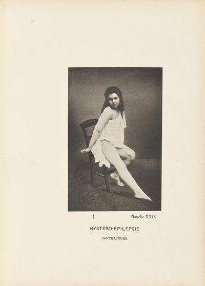 Hystero-epileptisk kontraktur af Paul Marie Léon Regnard