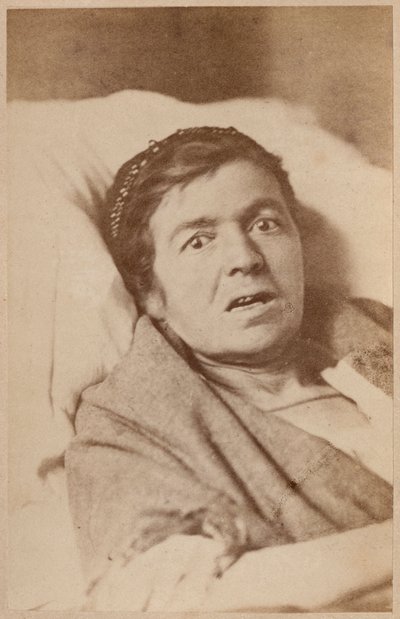 Hysterisk epilepsi, ansigtssammentrækning, plade VIII fra 