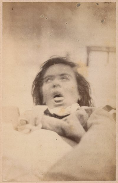 Hysterisk epilepsi, hallucinationer, kvaler, plade XXIX fra 