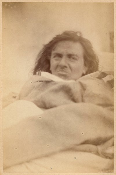 Hysterisk epilepsi, hallucinationer, modvilje, plade XXXV fra "Iconographie Photographique de La Salpetriere" af Bourneville et P. Regnard, Paris, 1876 (albumenprint) af Paul Regnard