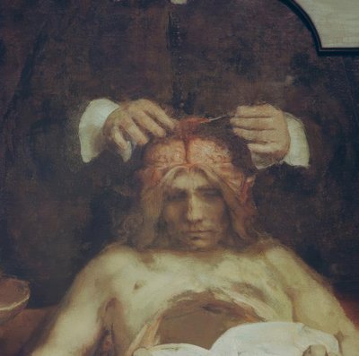 Anatomien af ​​Dr. Johan Deijman af Rembrandt van Rijn
