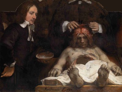 Dr. Jan Deijmans anatomi-lektion, 1656 af Rembrandt van Rijn