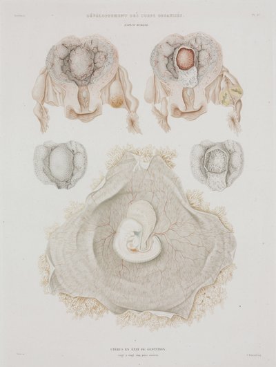 Gynækologi Menneskelig livmoder med embryo, c 1847-1859 af John Pardon