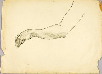 Undersøgelse af arm af Solon H. Borglum