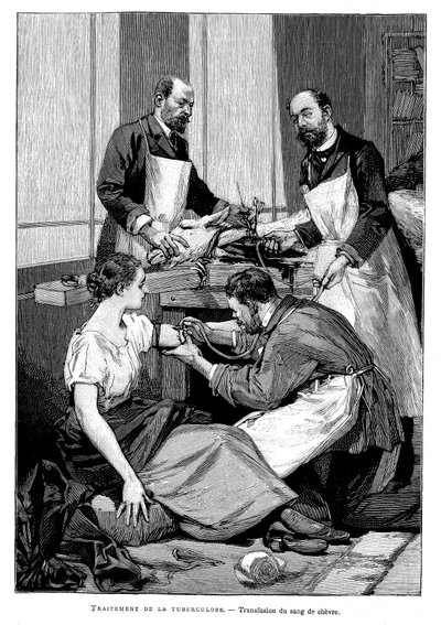 En tuberkulosepatient får en transfusion af gedeblod, 1891 af Unbekannt