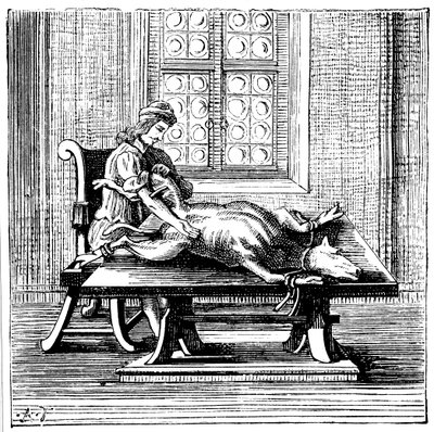 Dyre-til-menneske blodtransfusion, 1679 af Unbekannt