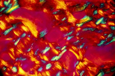 BIO-MATERIALER, LM Knogle af Unbekannt