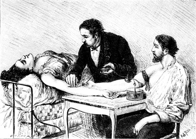 Dr. Roussell fra Genève gav en kvinde en direkte blodtransfusion fra en frivillig, 1882 af Unbekannt