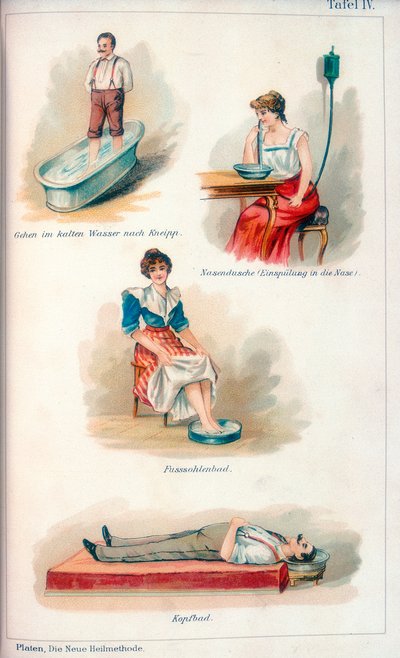 Hydroterapibehandlinger, c1902 af Unbekannt