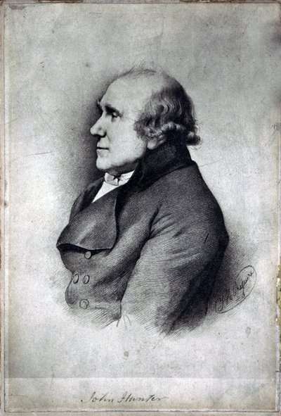 John Hunter, britisk kirurg og anatom, ca. 1770