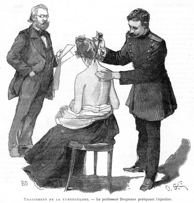 Professor Bergmann injicerer en tuberkulosepatient, 1891 af Unbekannt