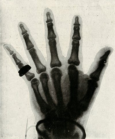 Røntgenbillede af hånden af H.R.H. Prinsen af Wales, c1897 af Unbekannt